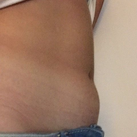 Dicker Bauch Die Meistgelesenen Fragen