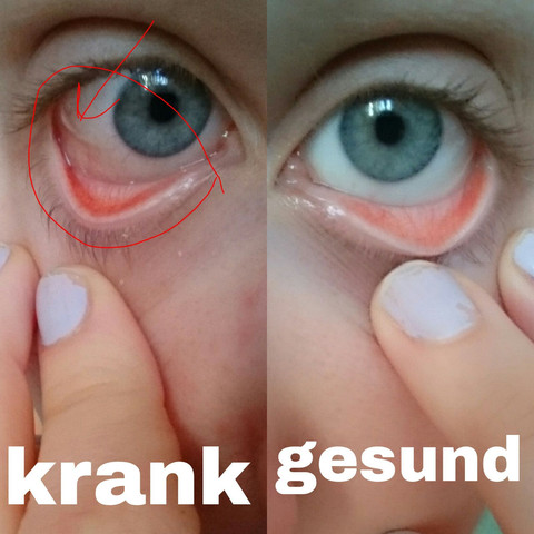 Auge - (Arzt, Schmerzen, Augen)