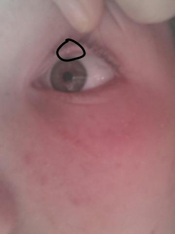 Auge Gelber Punkt O Augen Auge Gelber Punkt O Augen