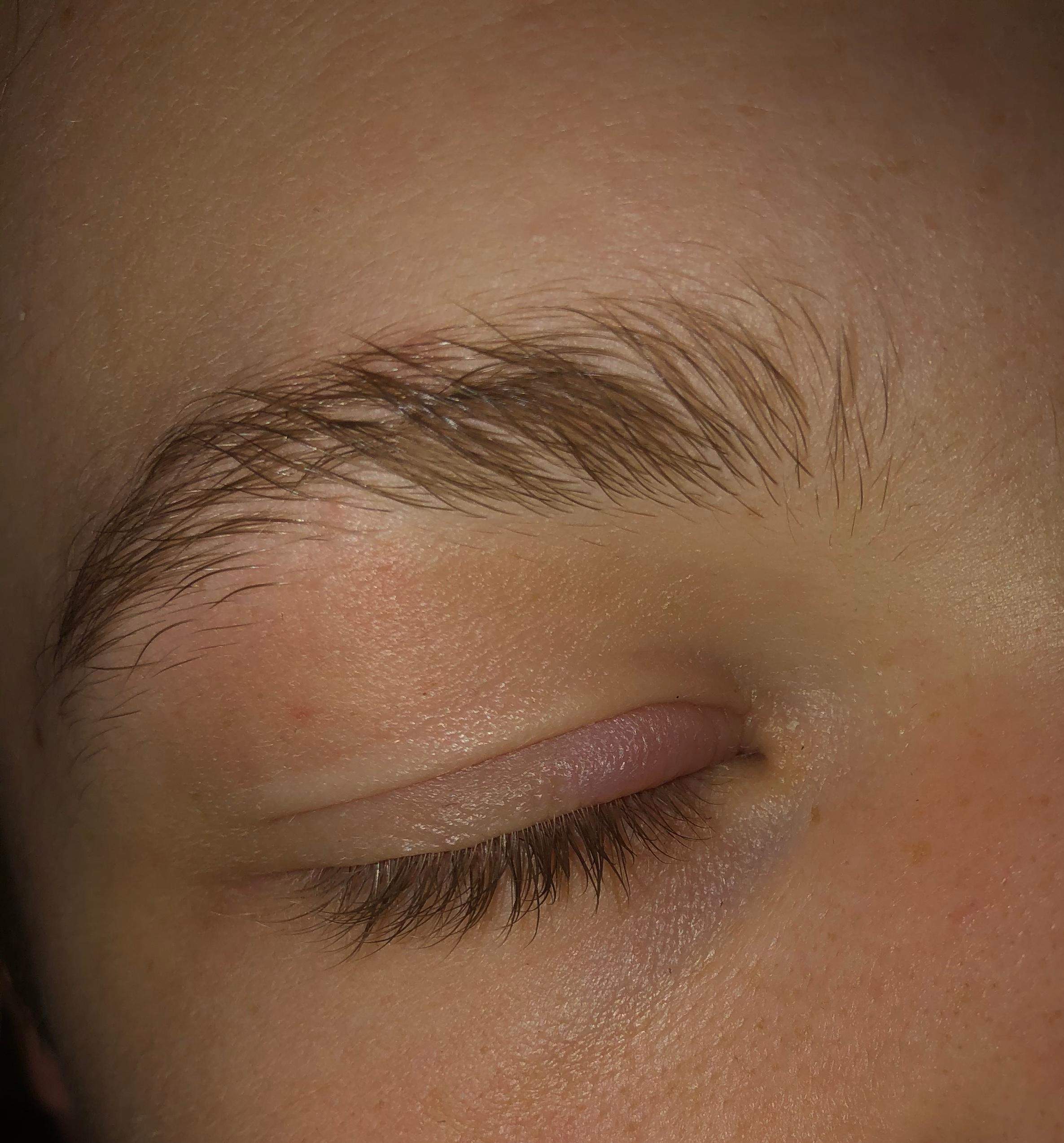 Auge geschwollen? (Gesundheit und Medizin, Gesundheit, Augen)