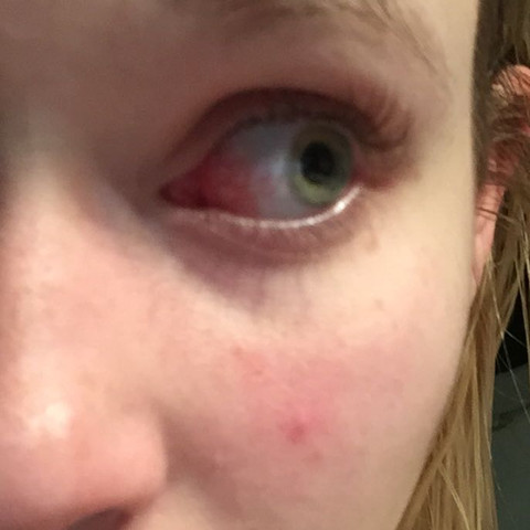 38+ neu Bilder Augen Innen Rot - Ursachen Fur Ein Rotes Auge Auge Online : Rot ist das auge, bzw.