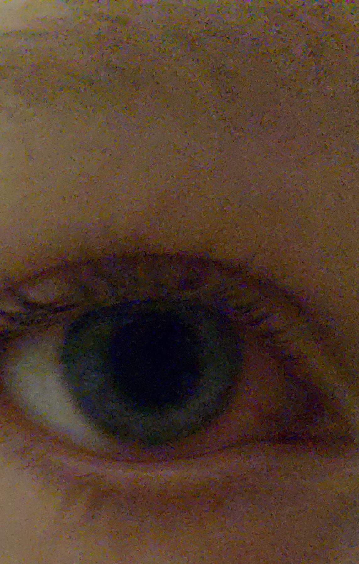 auge plötzlich so rot? (Gesundheit und Medizin, Augen)