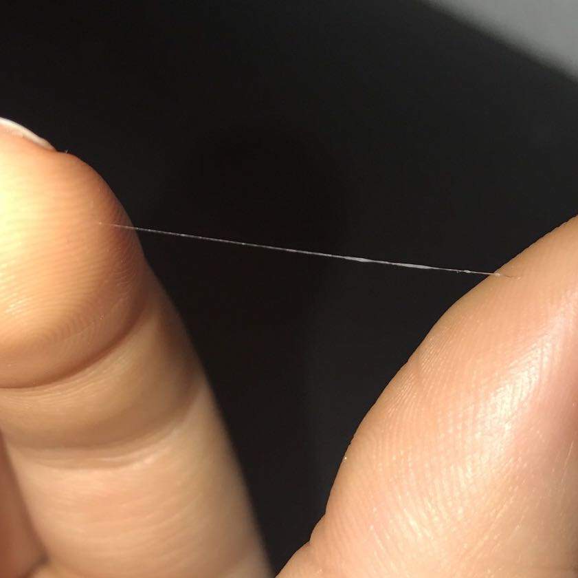 Am Schnellsten Augenlid Zuckt Seit Wochen Forum Am Schnellsten Augenlid Zuckt Seit Wochen Forum