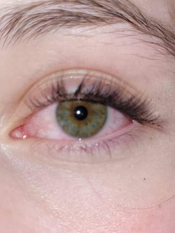 auge rot?