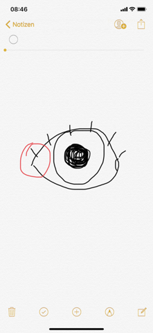 Auge Tut Beim Zukneifen Weh Gesundheit Und Medizin Gesundheit Arzt Auge Tut Beim Zukneifen Weh Gesundheit Und Medizin Gesundheit Arzt
