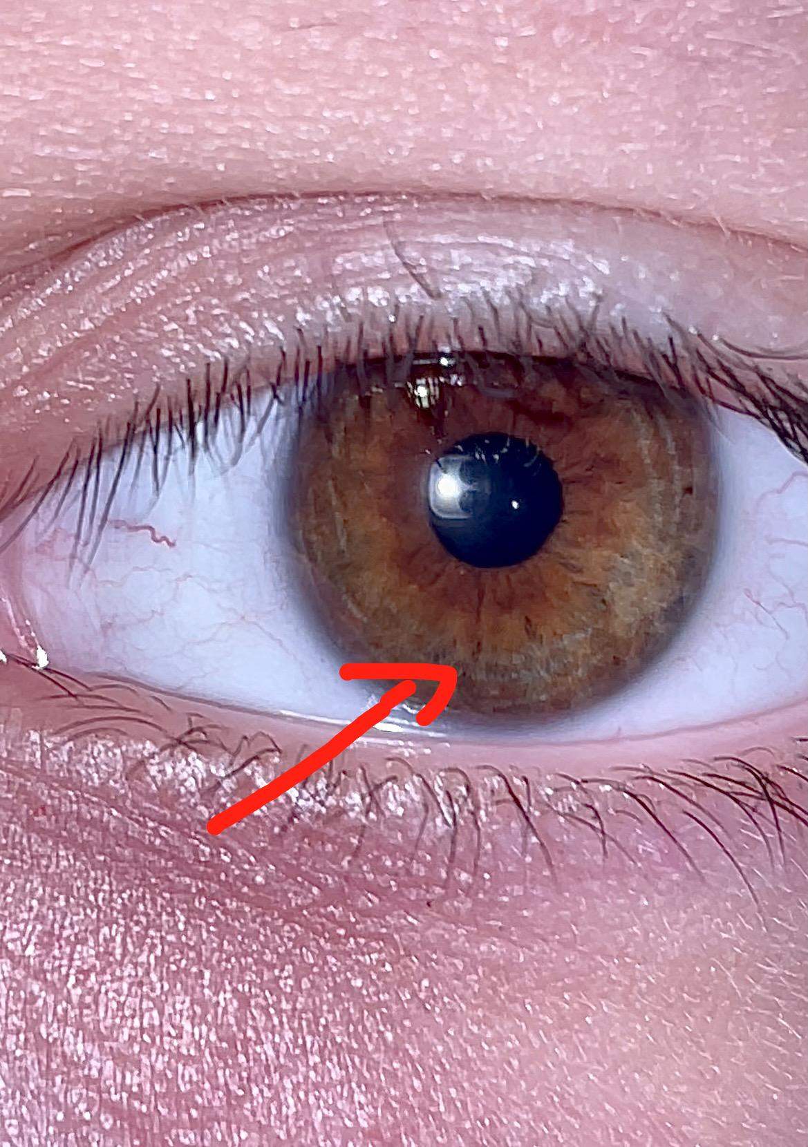 Auge iris Gesundheit Und Medizin Augen 