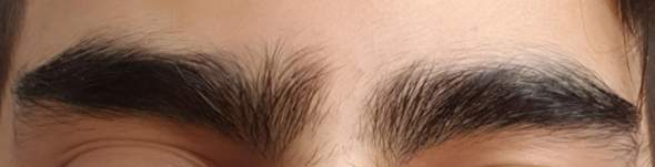 augenbrauen lasern ipl laser technik