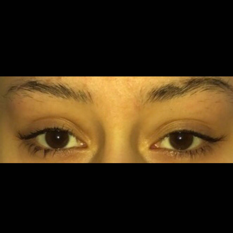 Augenbrauen Verlackt Wie Retten Zupfen Fail