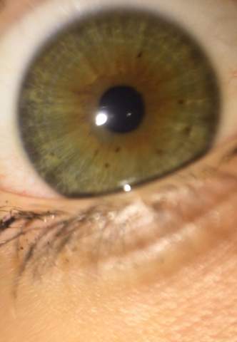 Augenfarbe?