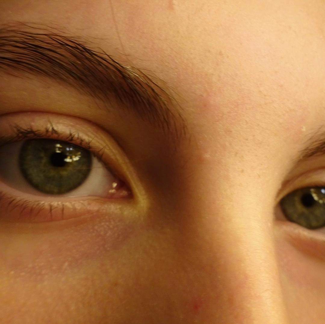 Augenfarbe ändert sich seit Jahren? (Aussehen)