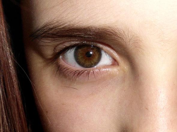 Augenfarbe Andert Von Braun Zu Grun Augen Veranderung