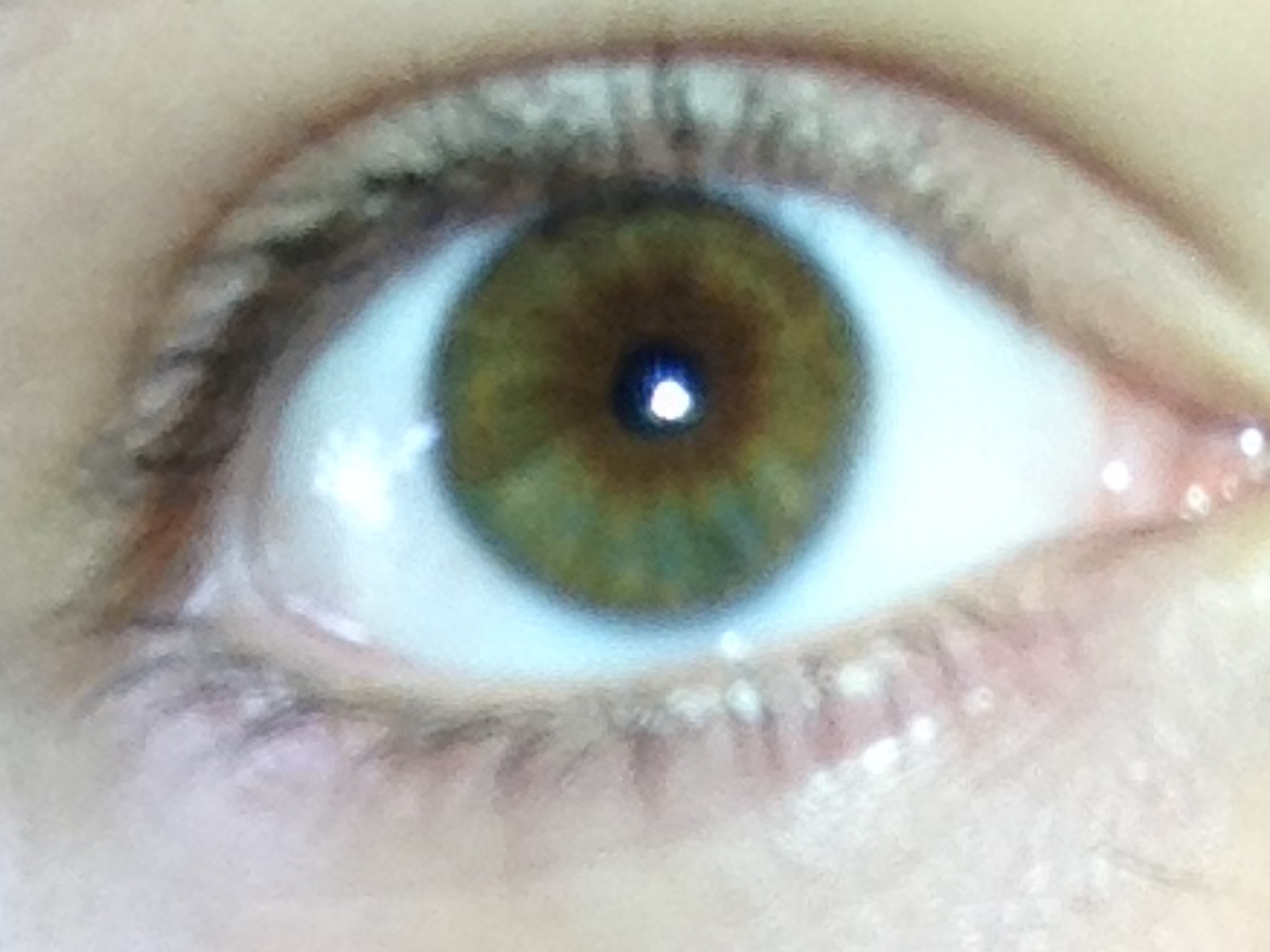Gemischte Augenfarbe