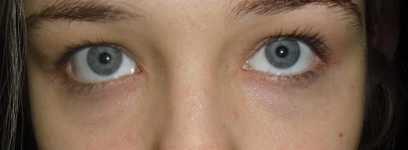 Augenringe Mit 17 Was Tun Beauty Augen Schonheit Augenringe Mit 17 Was Tun Beauty Augen Schonheit