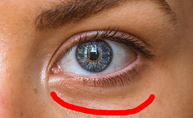 Augenzucken - Ursache? (Gesundheit, Medizin, Augen)