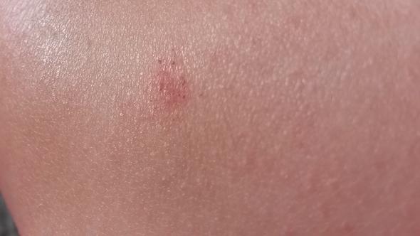 Rechtes Knie - (Gesundheit, Medizin, Haut)