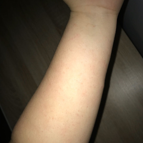 Arm🤯 - (Gesundheit und Medizin, Gesundheit, Arm)