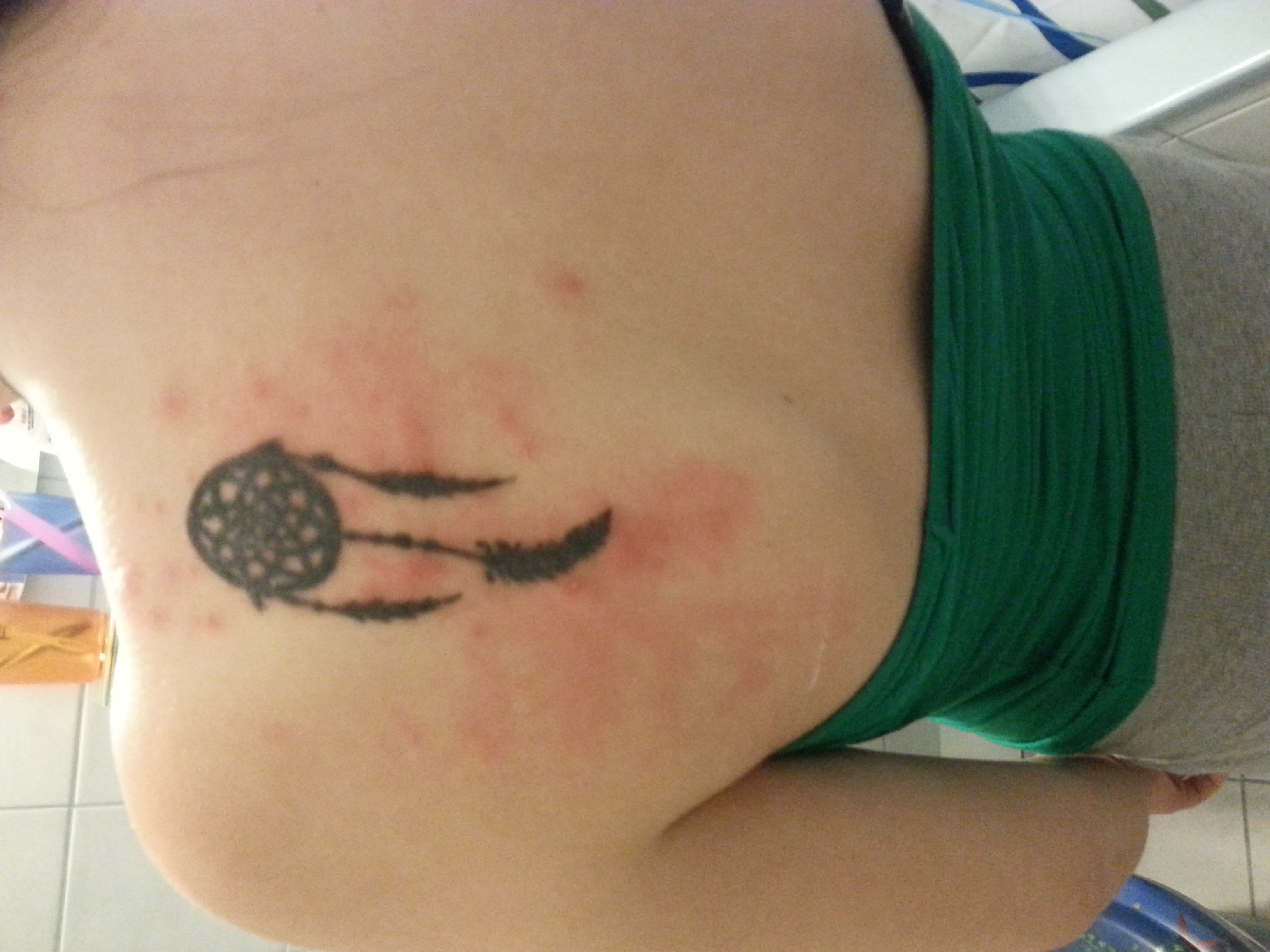 ausschlag problem mit tattoo (Allergie)