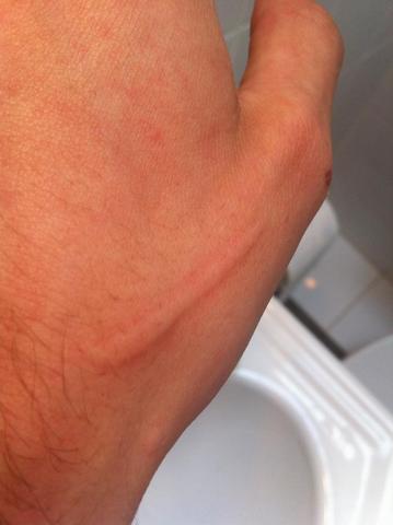 - (Hund, Haut, Verletzung)