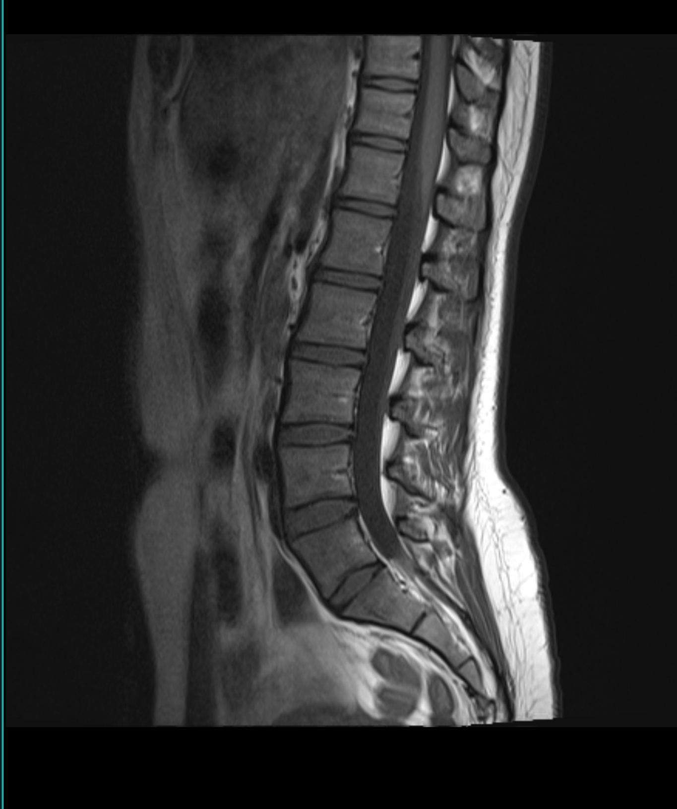 Auswertung meines MRTBildes? (Diagnose, MRT Befund) Auswertung meines MRTBildes? (Diagnose, MRT Befund)