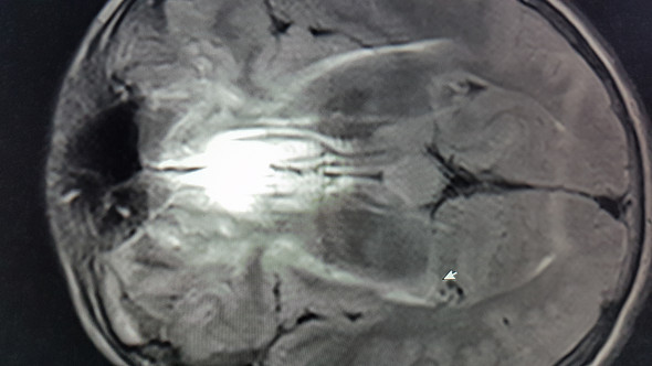 Auswertung SchädelMRT? (Medizin) Auswertung SchädelMRT? (Medizin)