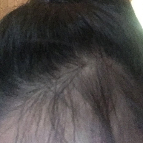 Babyhaar Wachst Noch Madchen Frauen Haare