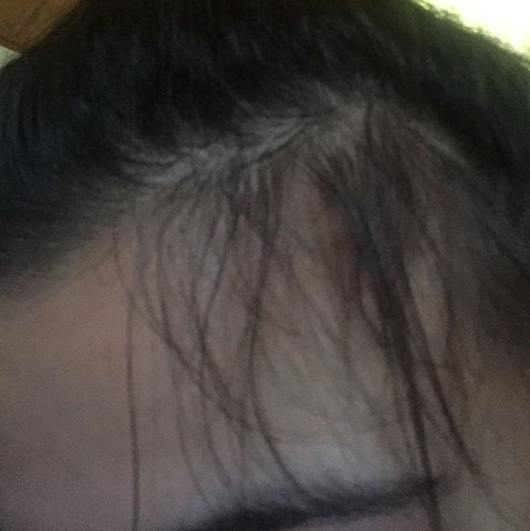 Babyhaar Wachst Noch Madchen Frauen Haare