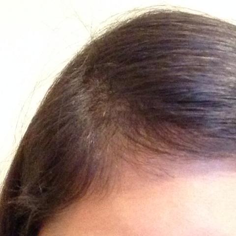 babyhaare problem haare beauty