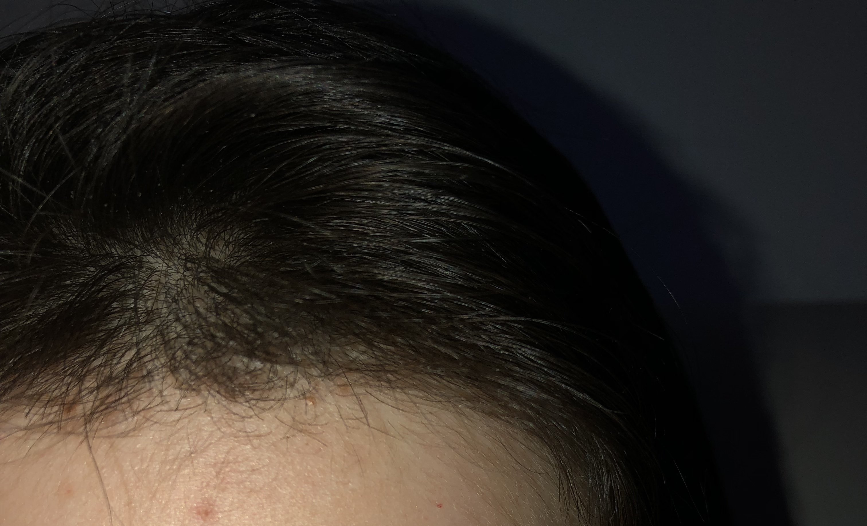 babyhaare wachsen wie lange dauert es