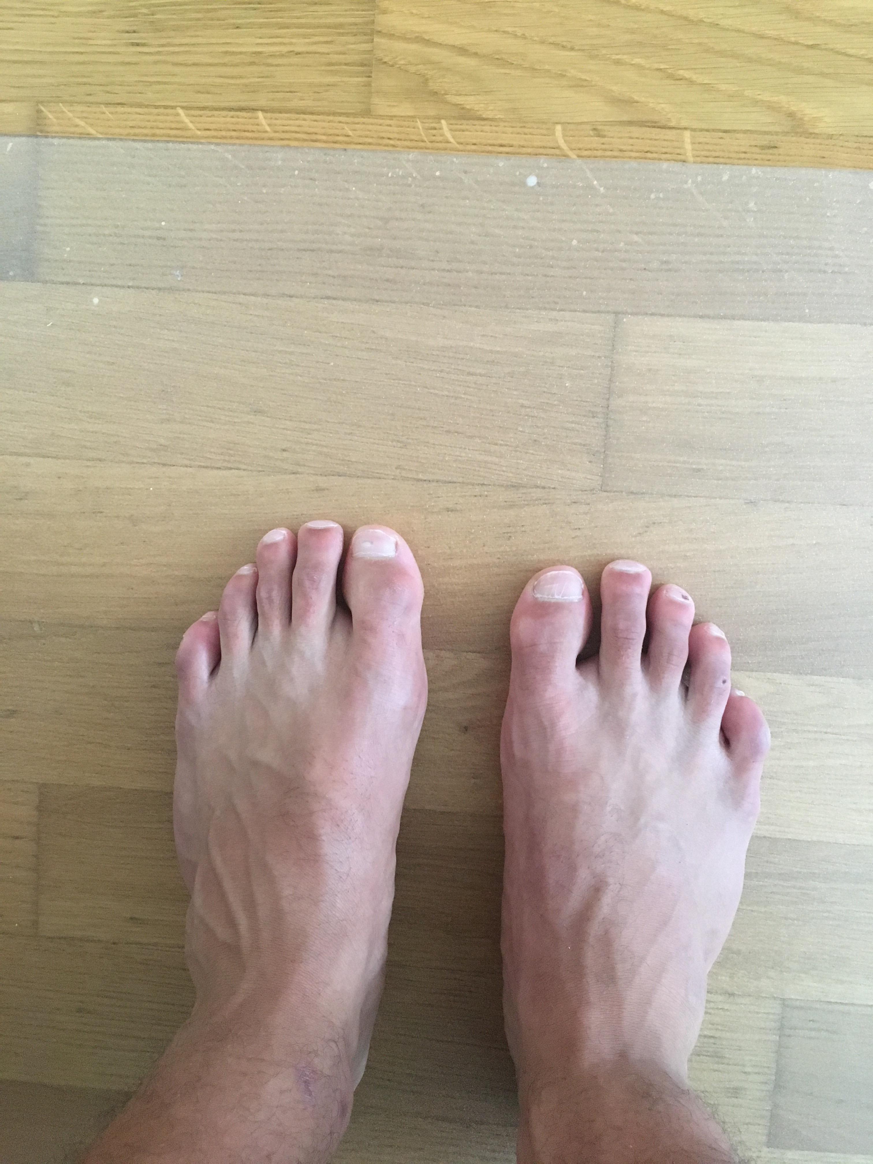 Banderdehnung Fuss Belasten Gesundheit Und Medizin Gesundheit Sport Und Fitness