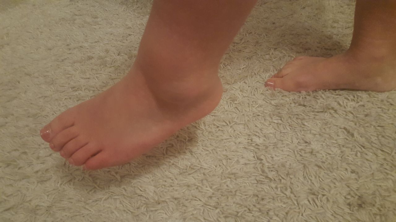 Bänderriss oder doch Sprunggelenksfraktur? (Gesundheit und Medizin, Gesundheit, Körper) Bänderriss oder doch Sprunggelenksfraktur? (Gesundheit und Medizin, Gesundheit, Körper)