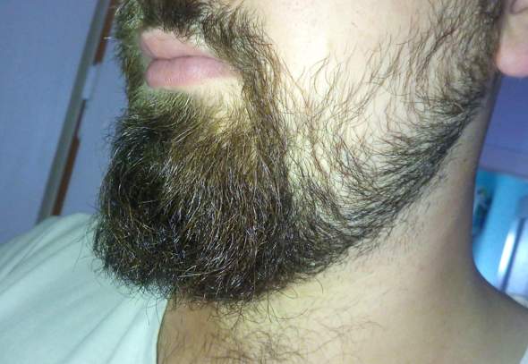 Bart auf wie viel mm trimmen, oder ganz ab?