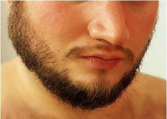 Bart kürzer oder länger tragen?