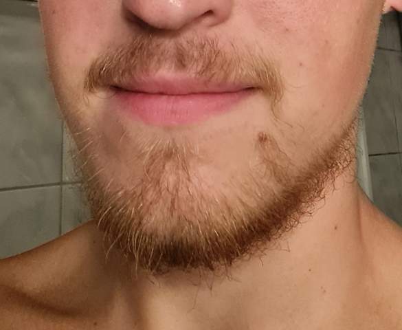 Bart lassen oder abrasieren?