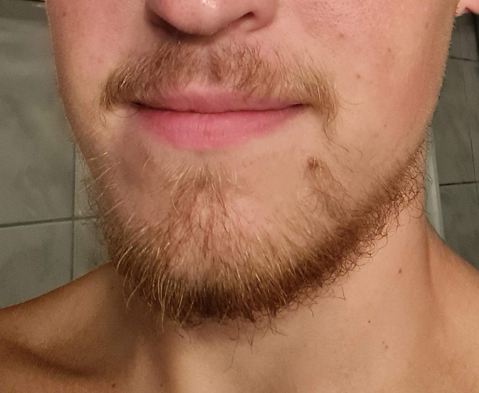 Bart Wachsen Lassen Sieht Ungepflegt Aus Bart lassen oder abrasieren? (Jungs, Pflege, Wachstum)
