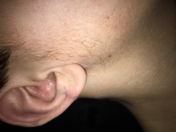 Bart Mit 15 Jugendliche Teenager