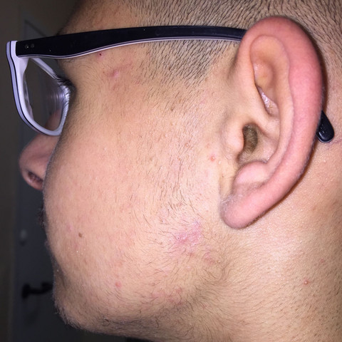 Bart Wachst Komisch Tipps Gesundheit Und Medizin Gesundheit Pflege