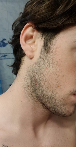 Bart Wachst Ungleichmassig Jsisbs Gesicht