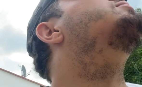 - (Haare, Hautarzt, Haarausfall)