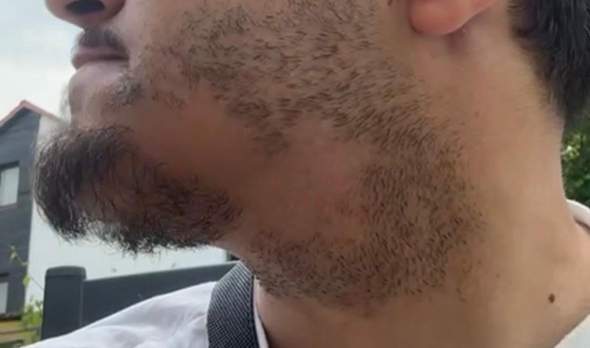 - (Haare, Hautarzt, Haarausfall)