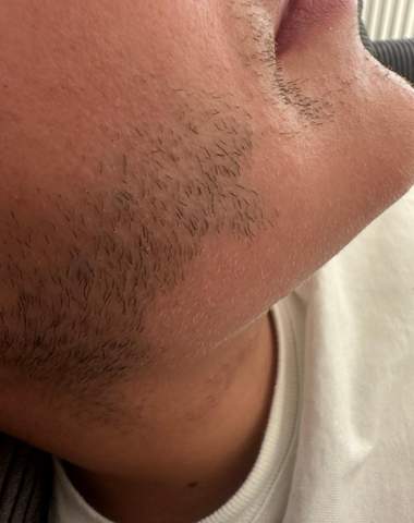 - (Haare, Hautarzt, Haarausfall)