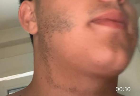 - (Haare, Hautarzt, Haarausfall)