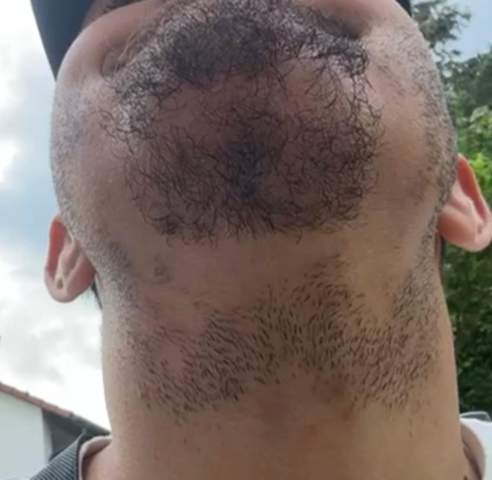 - (Haare, Hautarzt, Haarausfall)