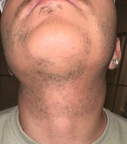 - (Haare, Hautarzt, Haarausfall)