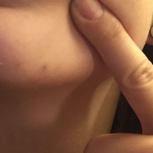 barthaar am kinn frau madchen