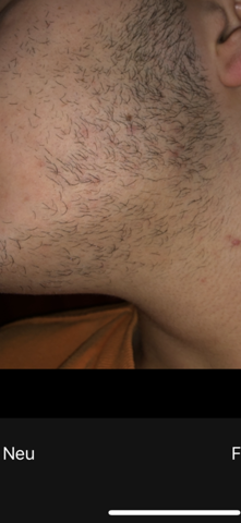 Barttrimmer Rasierer Empfehlung Jugendliche Bart Elektrorasierer