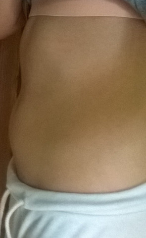 bin 1.57 gross, 44 kg schwer.bekomm den bauch nicht weg! - (Sport, Ernährung)