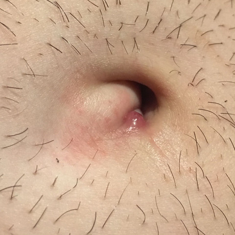 Knubbel Die Meistgelesenen Fragen Knubbel Die Meistgelesenen Fragen