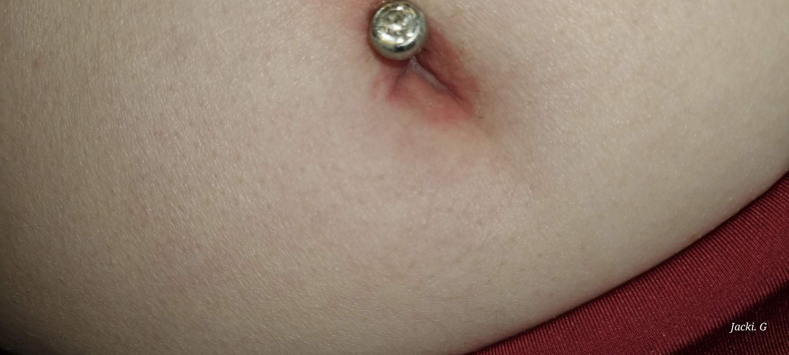 Bauchnabel ist rot dazu ein entzündetes piercing, was tun? (Entzündung ...