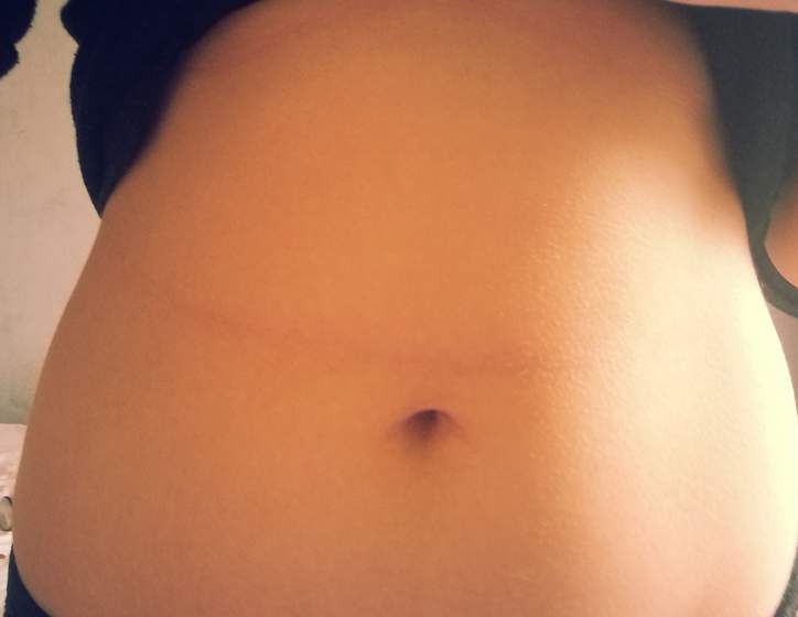 Ab Wie Vielen Jahren Ist Ein Bauchnabelpiercing