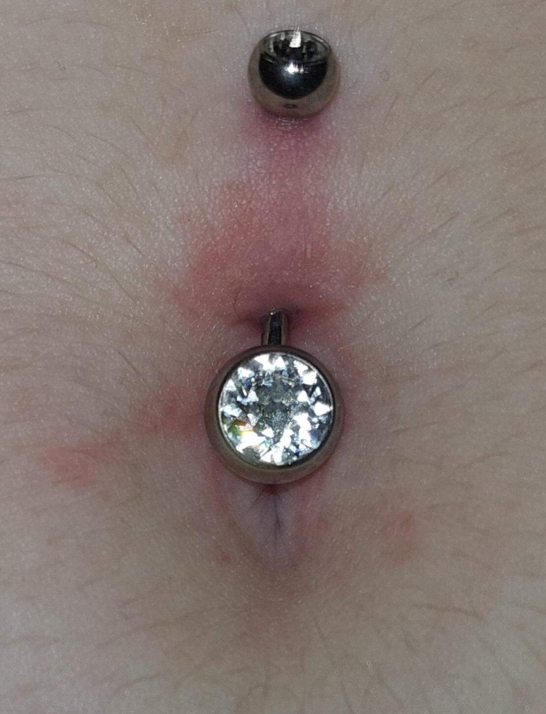 Bauchnabelpiercing auf einmal rot, warum? (Schmerzen, Piercing, Bauchnabel)